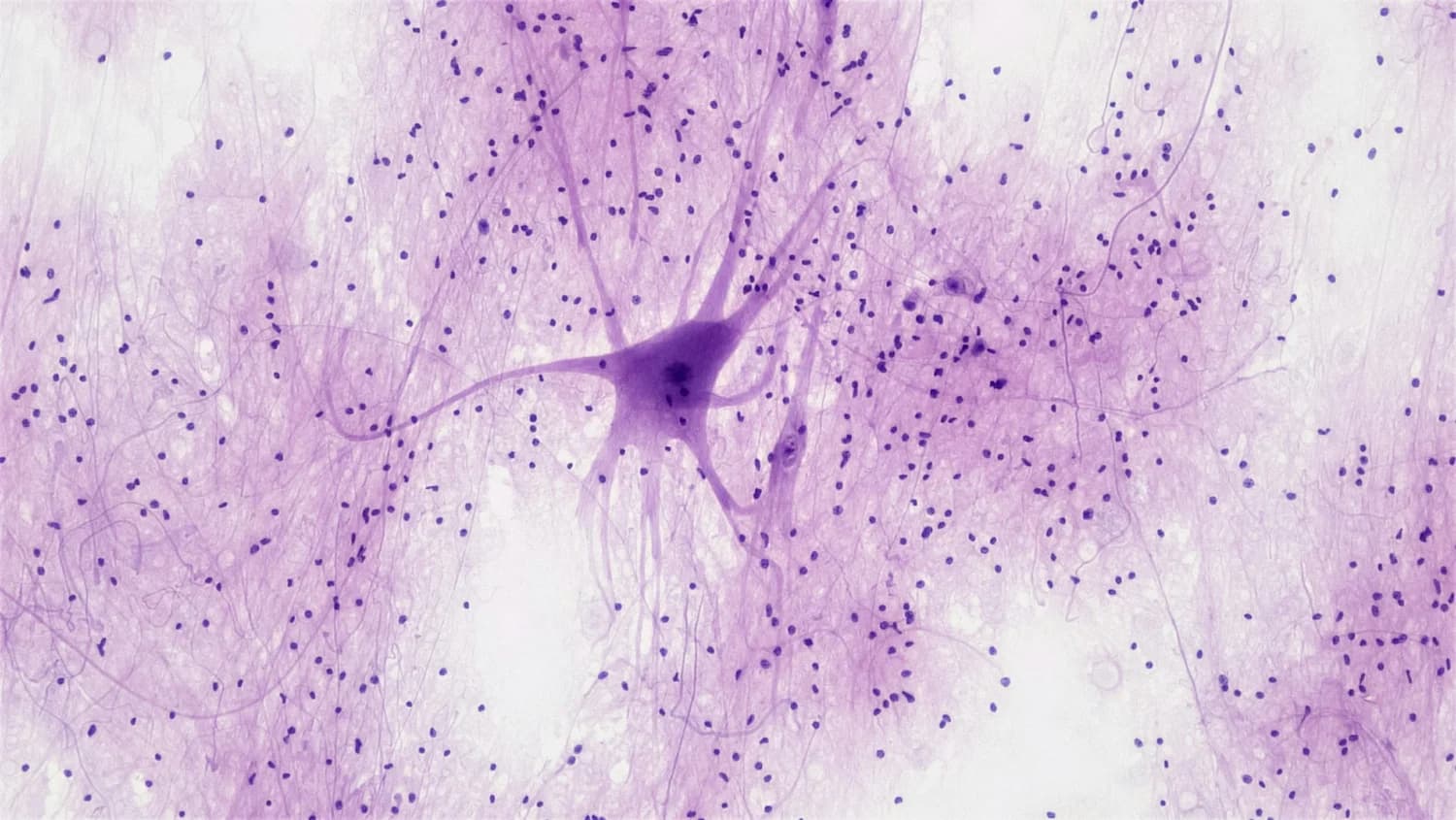 Neuroplasticità